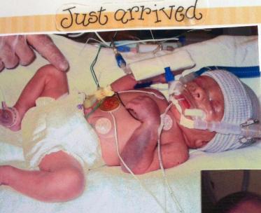 Jacob preemie pic